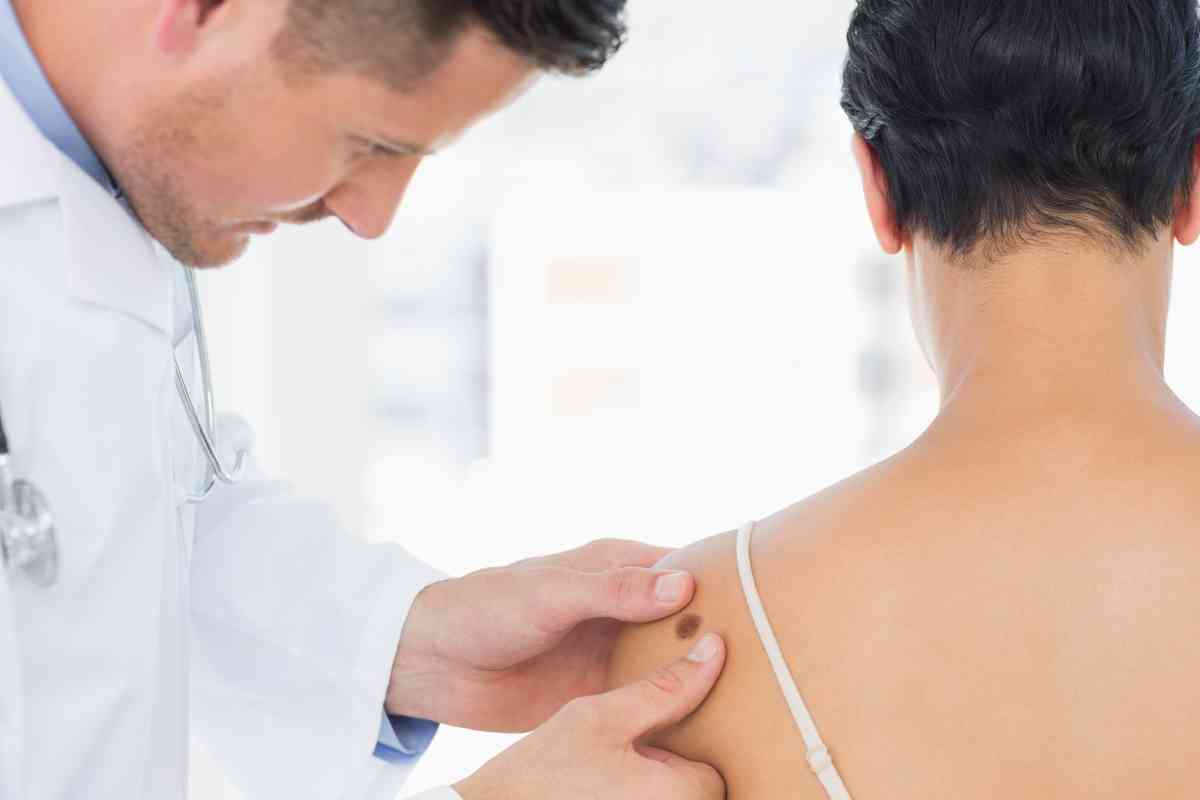Melanoma, scoperta rivoluzionaria
