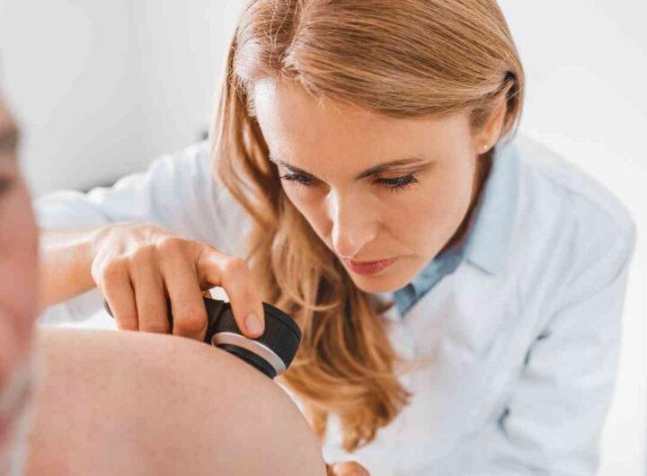 Melanoma, scoperta rivoluzionaria, tutti i dettagli